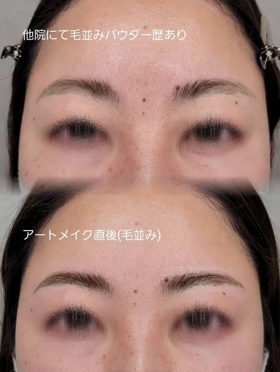 眉アートメイク毛並みリタッチ施術前後(他院施術歴あり)